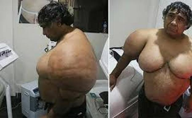 La increíble deformación del cuerpo de un buceador