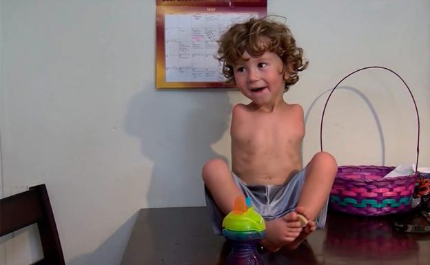 Echan a un niño sin brazos de un restaurante por utilizar los pies para comer